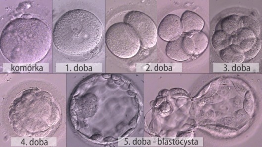 http://www.tvn24.pl/wiadomosci-z-kraju,3/od-jajeczka-do-blastocysty-tak-rodzi-sie-zycie,321267.html